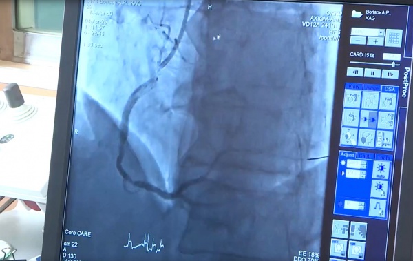 Врачи ОКБ спасли пациента с инфарктом