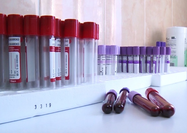 В регионе ежегодно выявляется 150–200 случаев ВИЧ