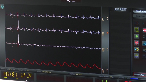 В ОКБ появился аппарат для проведения УЗИ сердца на велотренажере