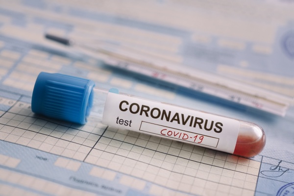 За сутки в Рязанской области выявили 52 случая заражения коронавирусом